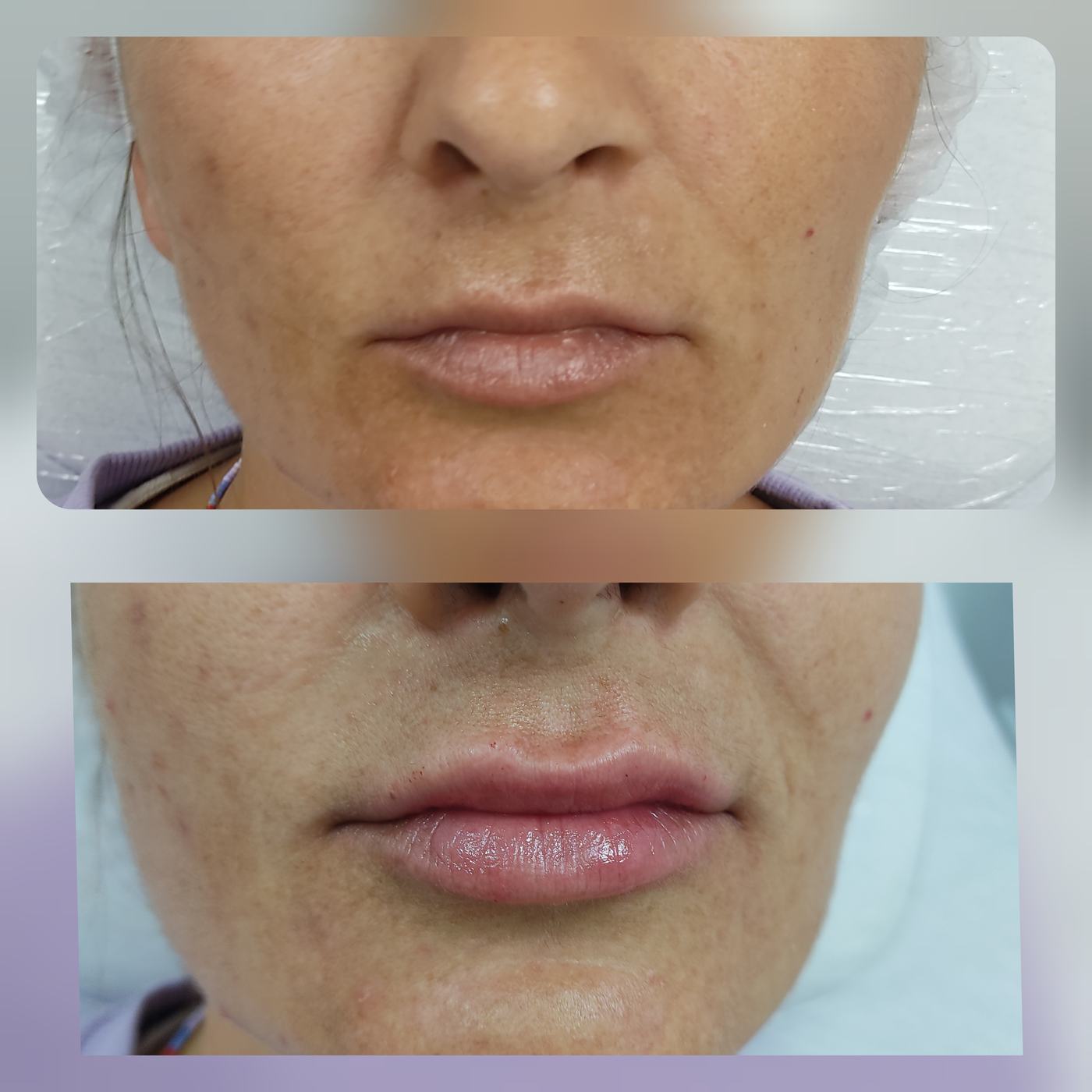 Resultados de labios