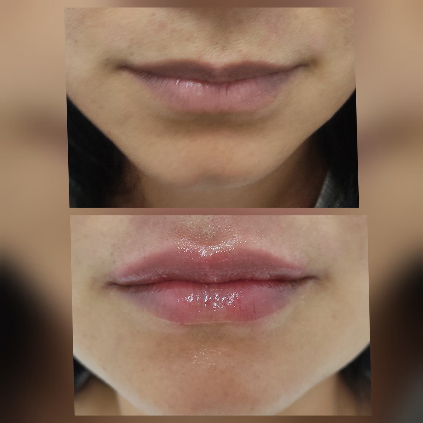 Labios — fotografía clínica real