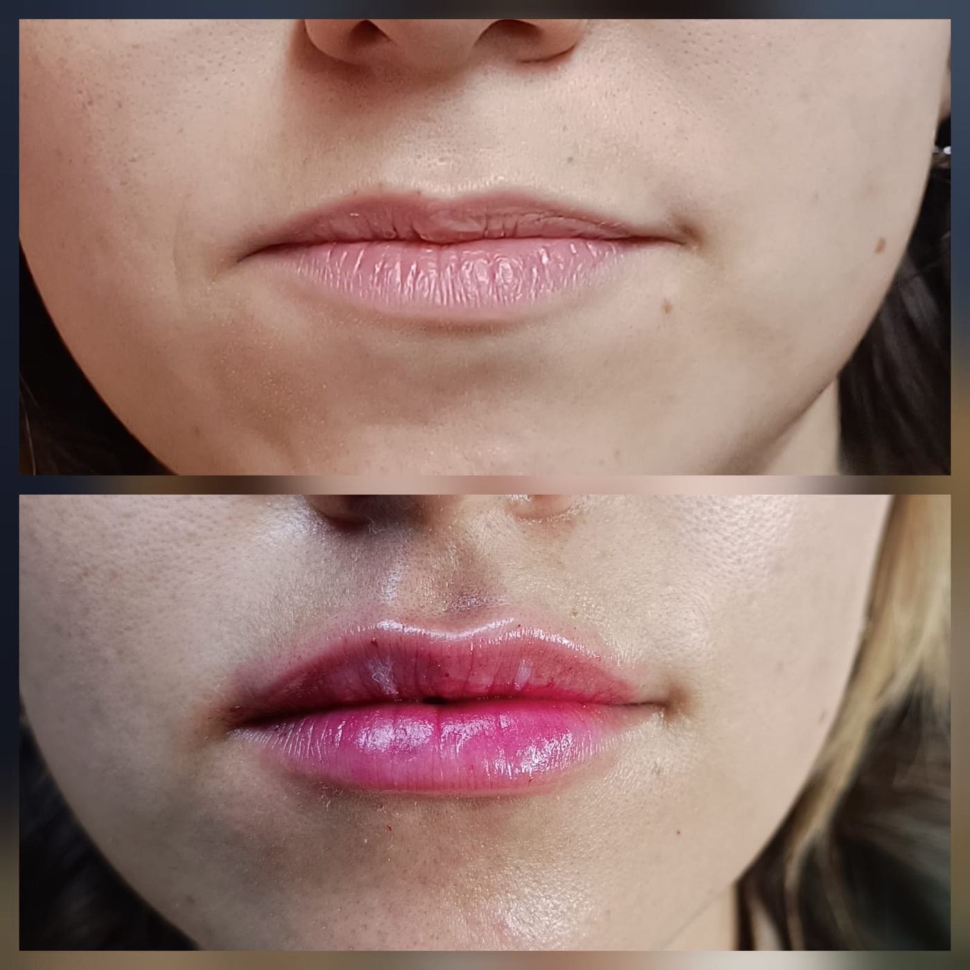 Labios — fotografía clínica real